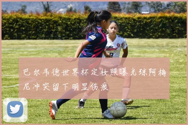 巴尔韦德世界杯定妆照曝光琼阿梅尼冲突留下明显伤痕
